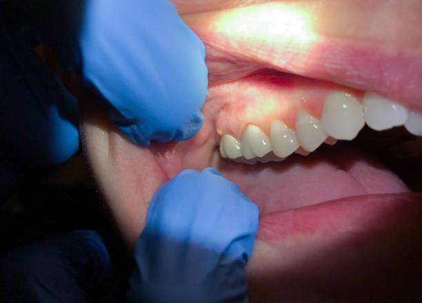 Best Weekend Emergency Dentist in Messiah College, PA